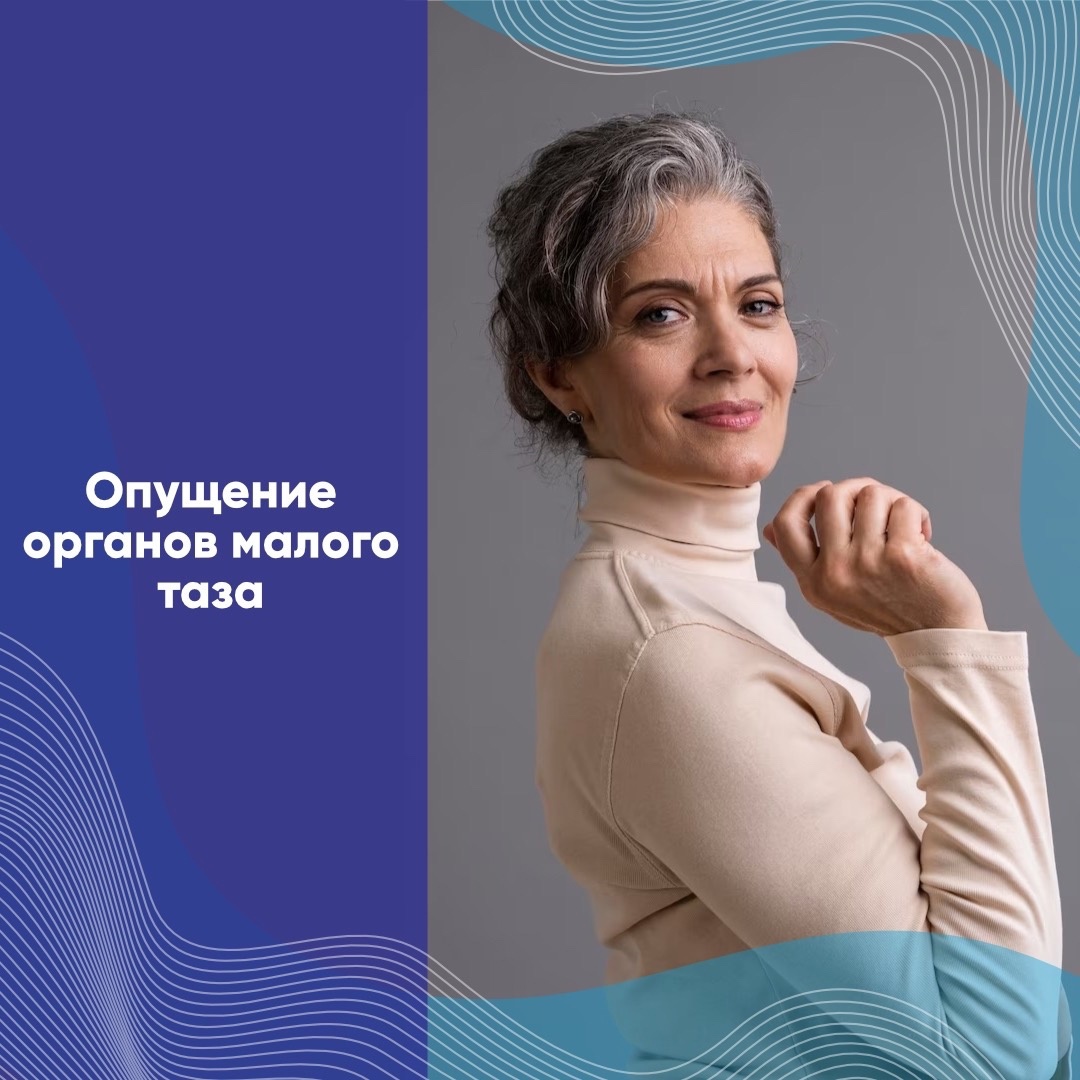 Опущение органов малого таза Опущение органов малого таза