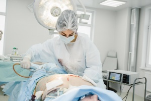 Липосакция